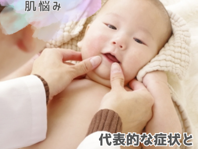 赤ちゃんの肌悩みを予防するために知っておきたい！代表的な症状と原因×対策をご紹介
