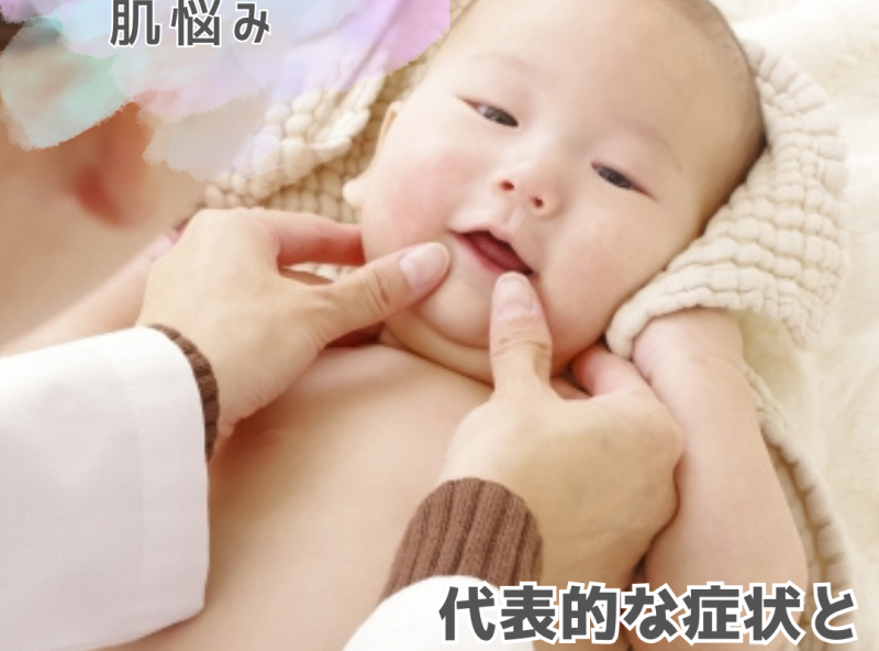 赤ちゃんの肌悩みを予防するために知っておきたい！代表的な症状と原因×対策をご紹介